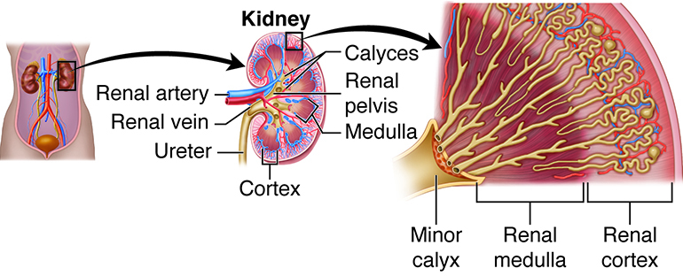 Kidney Stones